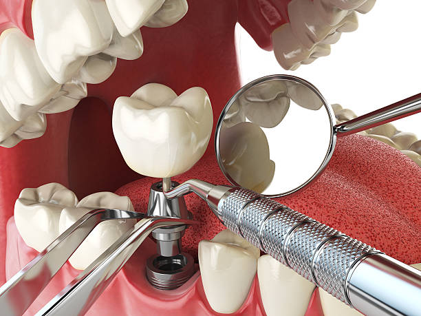 Best Emergency Broken Tooth Repair in Polo, IL